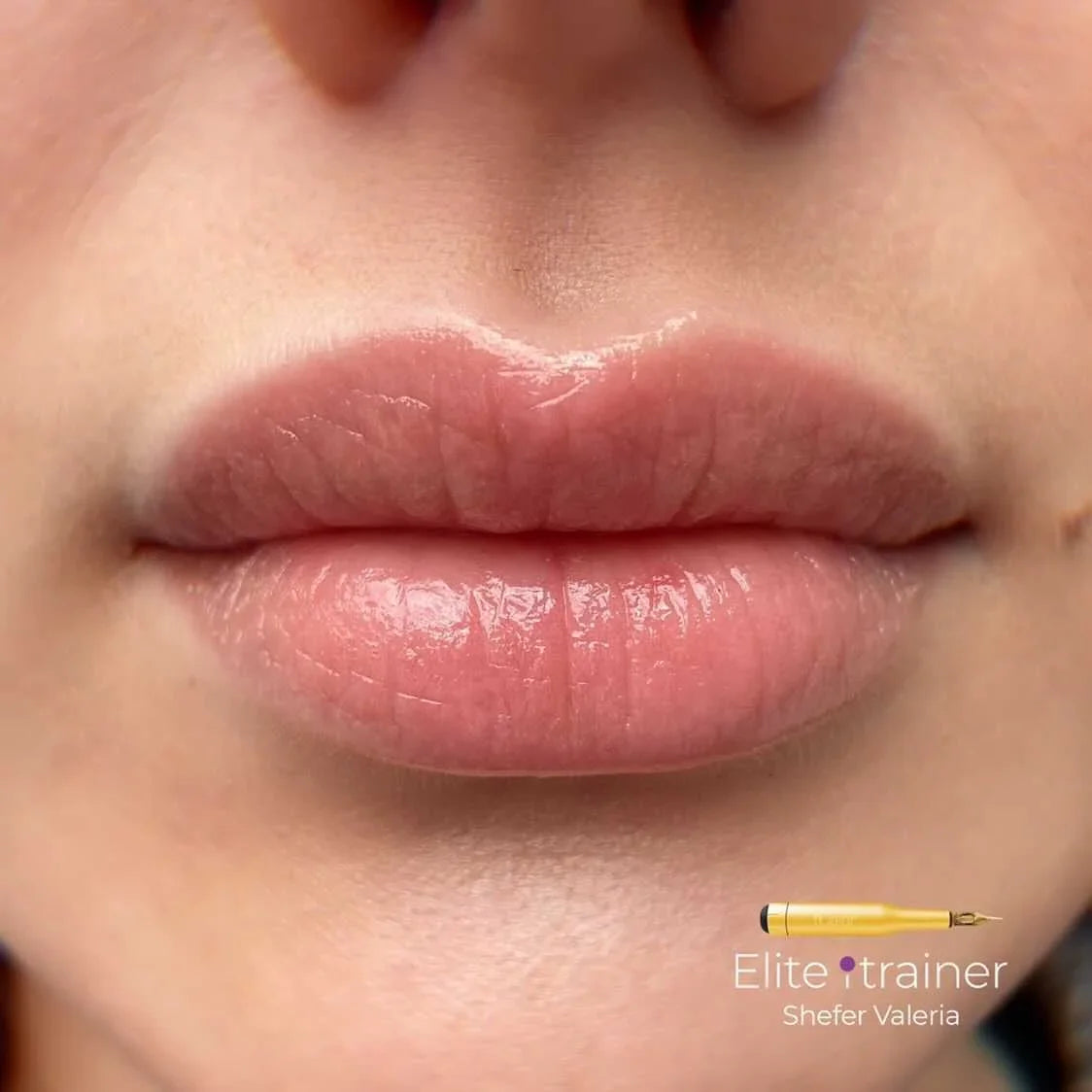 Healed result of Tint Coral – soft coral tint