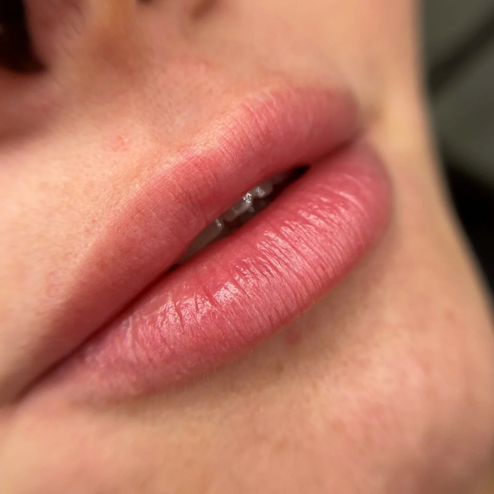 Healed result of Tint Coral – soft coral tint
