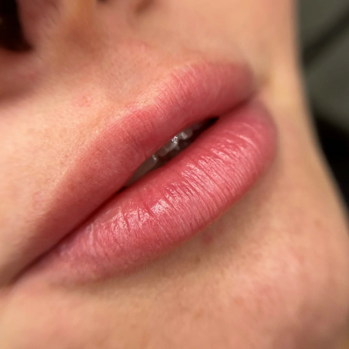 Healed result of Tint Light Orhide – glossy pink tint