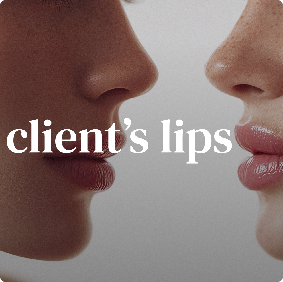 Client Lips online course – treat different lip types thumbnail