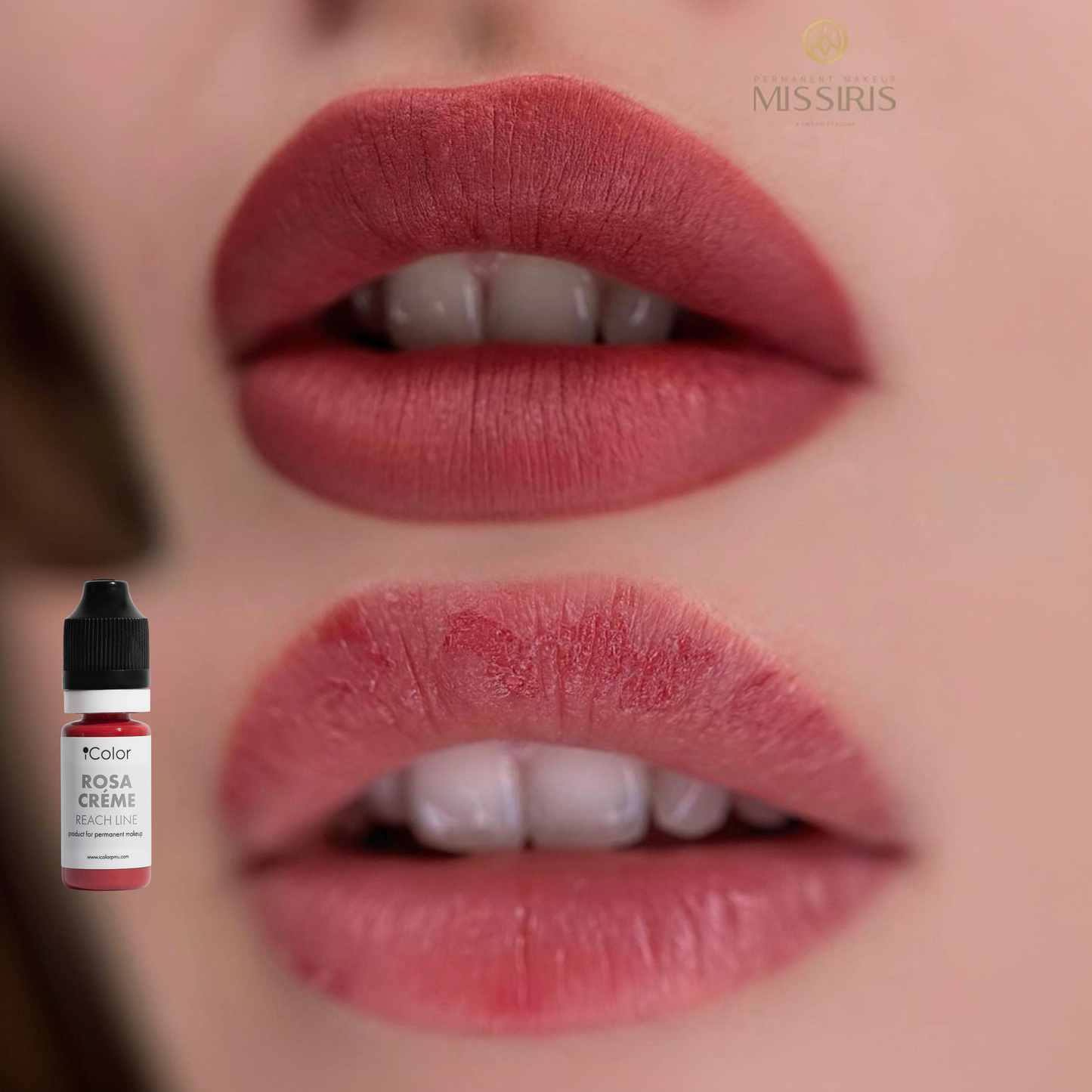 Additional healed work – Rosa Creme covering titanium dioxide residue