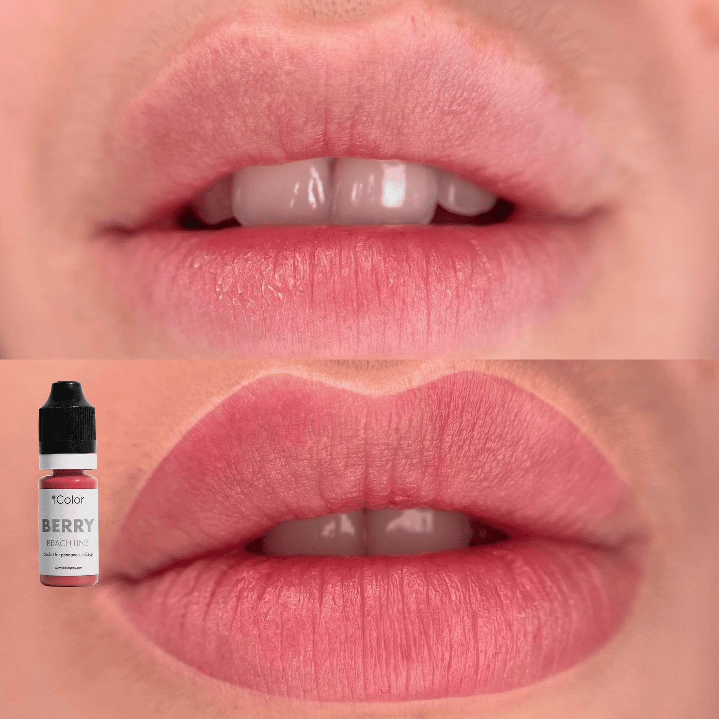 Berry • 10ml