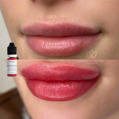 Watermelon • 10ml