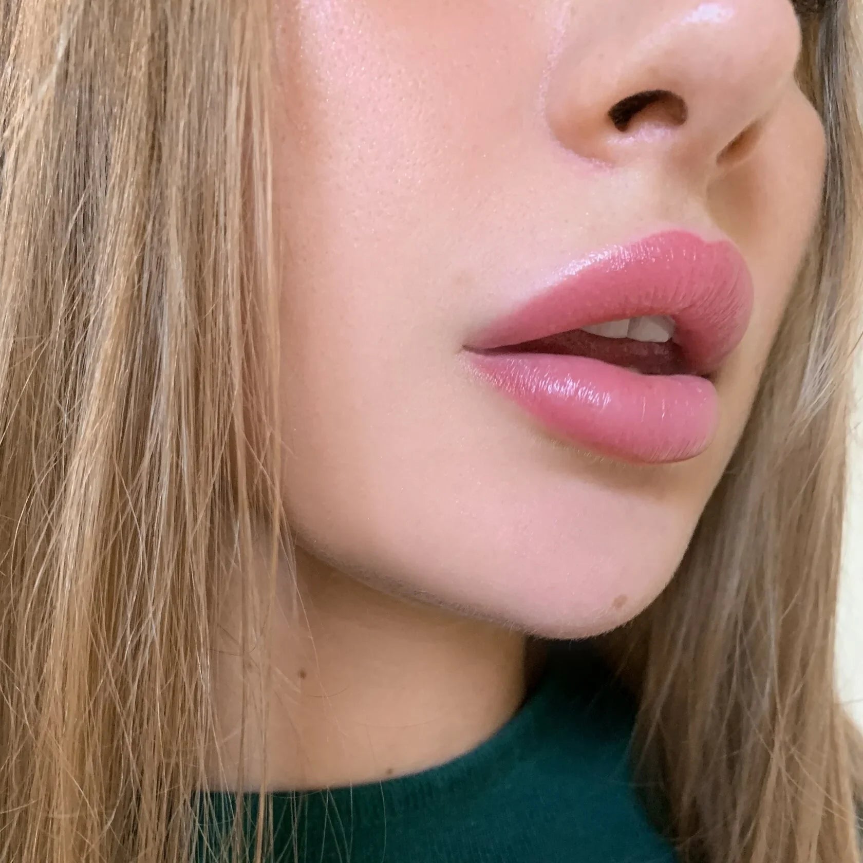 Healed result of Tint Pink – natural pink lips