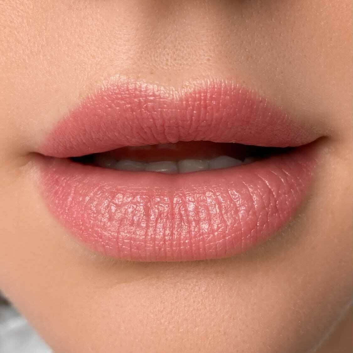 Healed result of Tint Coral – soft coral tint