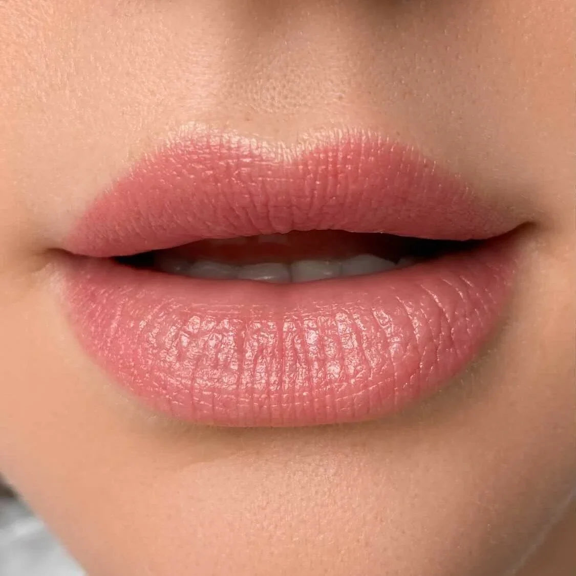 Healed result of Tint Coral – soft coral tint