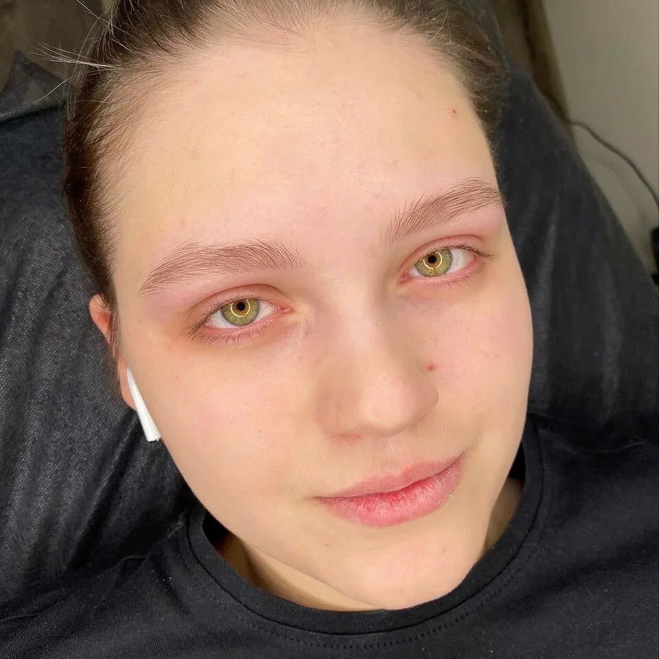 Healed result of Tint Light Orhide – glossy pink tint